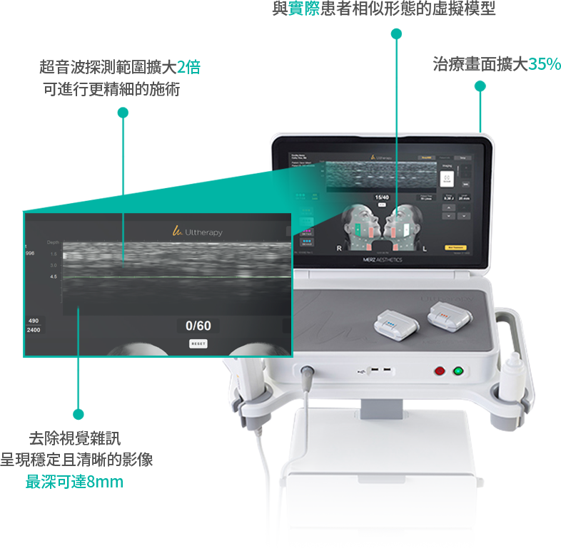 ultheraprime image