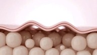 line 2 image