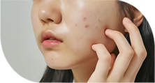 毛孔/疤痕
