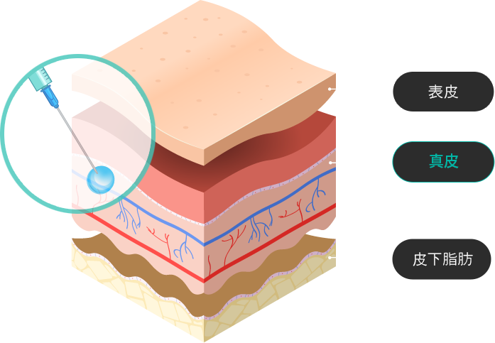 Treatment process image